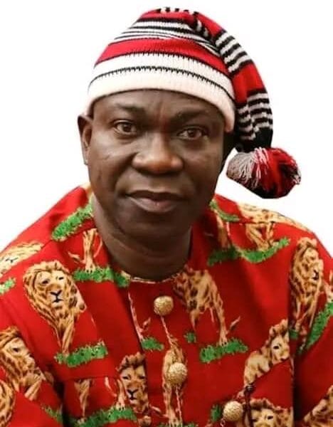 Organ Harvest: Lincoln University Bans Ekweremadu