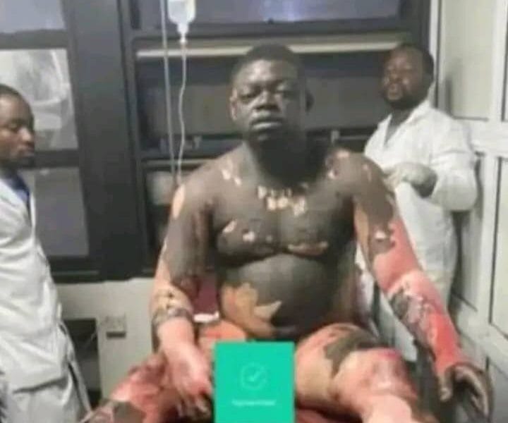 Alleged Infidelity: Jealous Wife Sets Cairo-Based Husband Ablaze In Osogbo