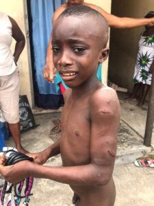 Delta: Police Arrest Woman For Torturing Son With Cutlass, Rod