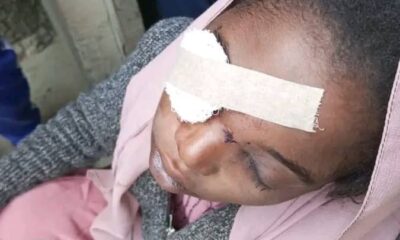 Kano Bride Injured During Scuffle On Wedding Day