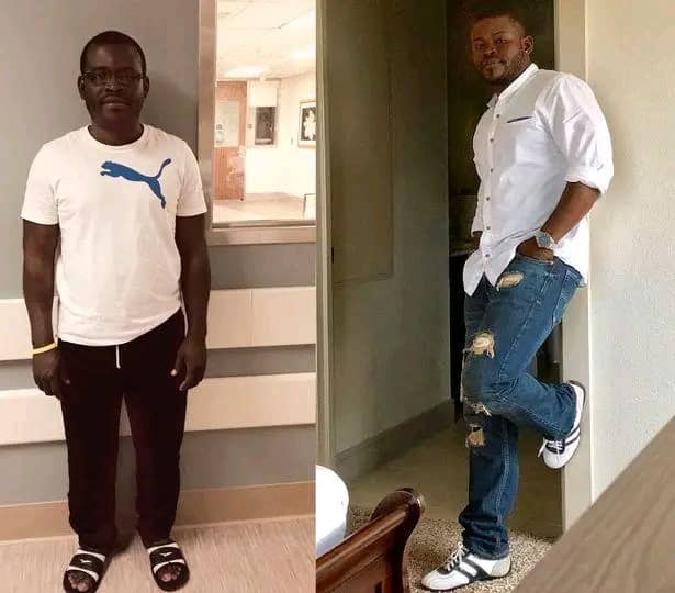 Man Undergoes Height Lengthening Surgery To Grow Taller