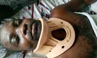 Heroic Agbarho Tanker Driver In Critical Condition After Car Accident