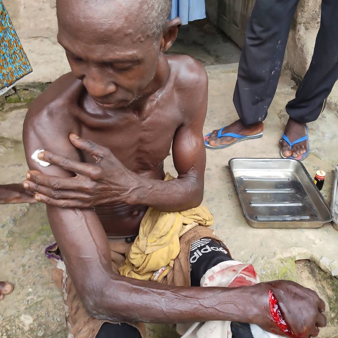 Uduophori People Cry Out Over Attacks Of Herdsmen