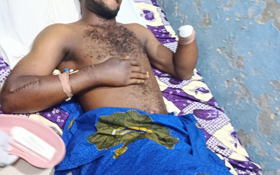 Uduophori People Cry Out Over Attacks Of Herdsmen