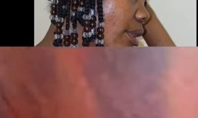 Woman Alleges Brutal Flogging By Police Officers At Ugborikoko Division, Seeks Justice