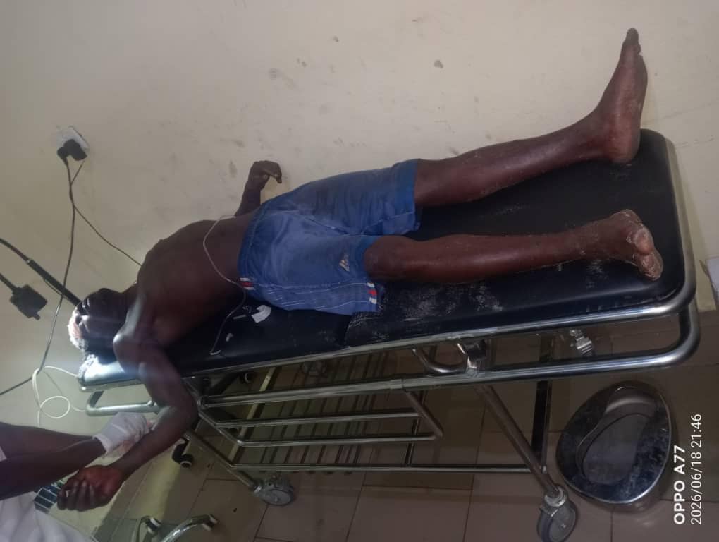 Panic In Ughelli As Suspected Fulani Gunmen Shoot Resident, Ambush Tantita Operatives